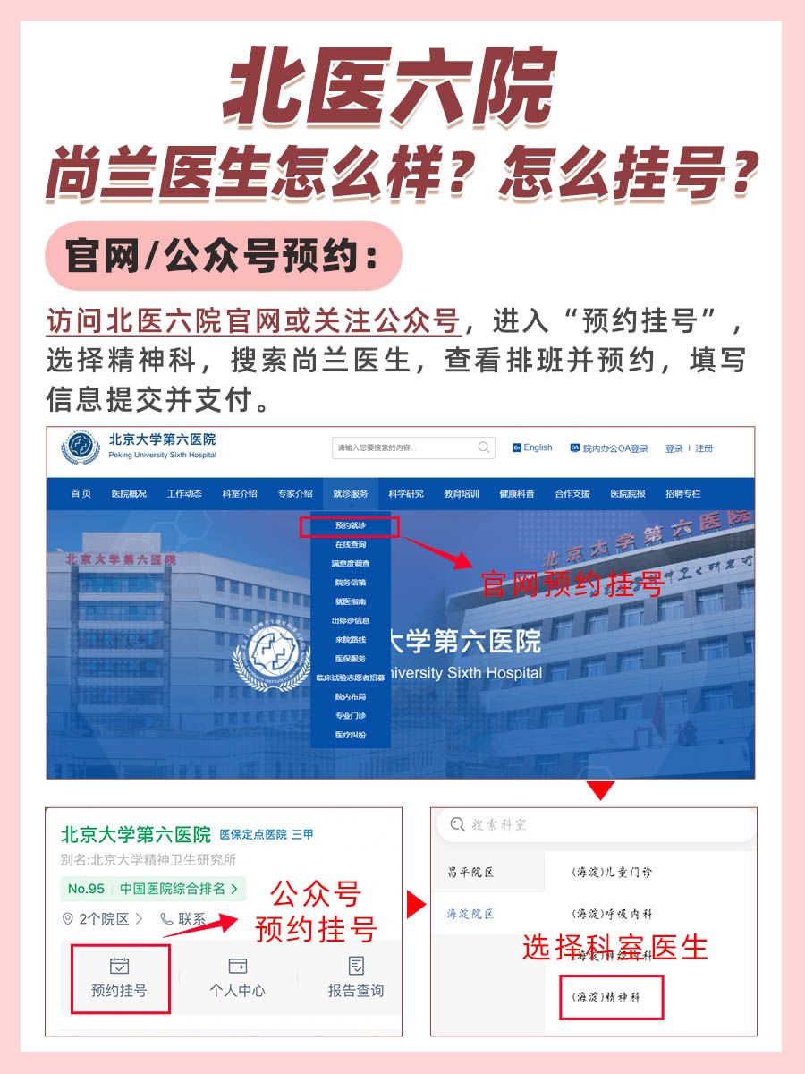北京大学第六医院尚兰医生怎么样？怎么挂号？