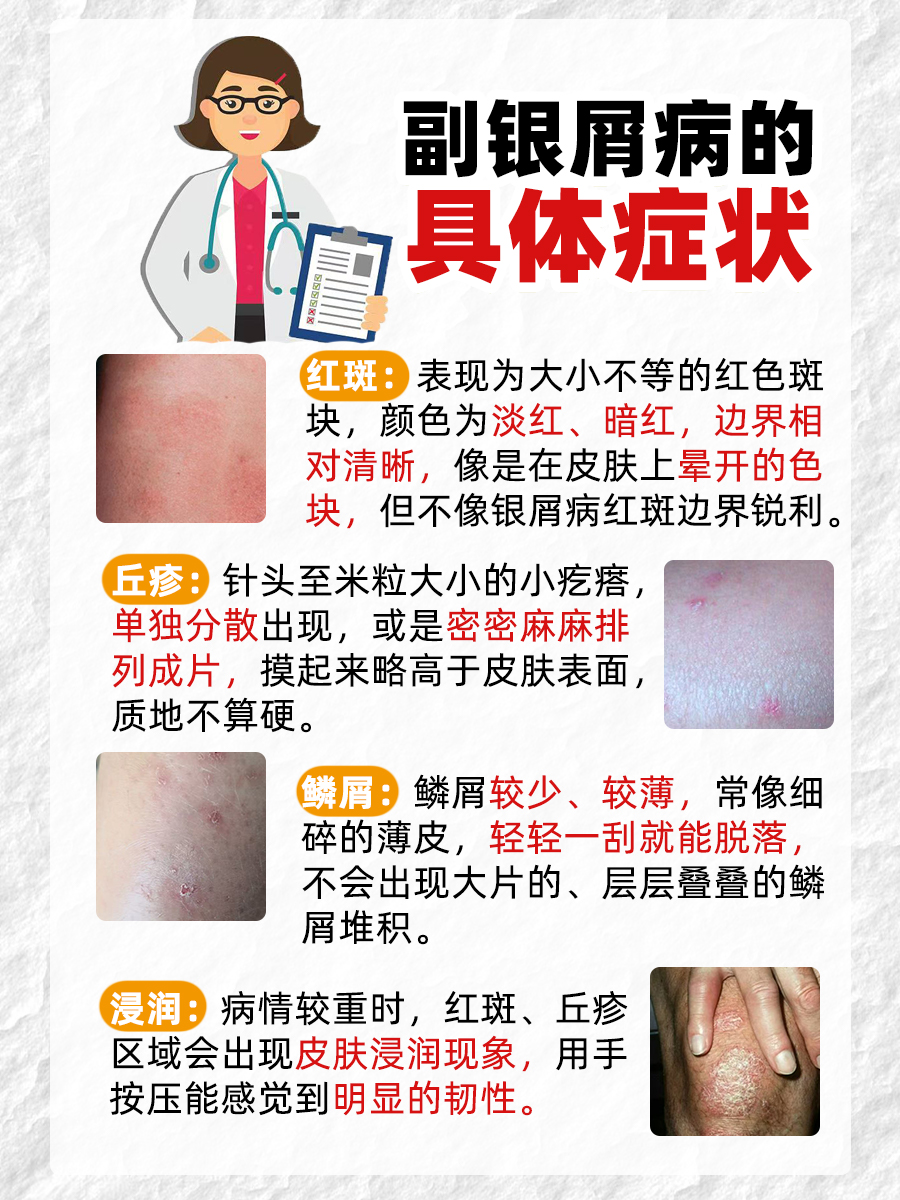 冲！副银屑病有啥症状？在线划重点