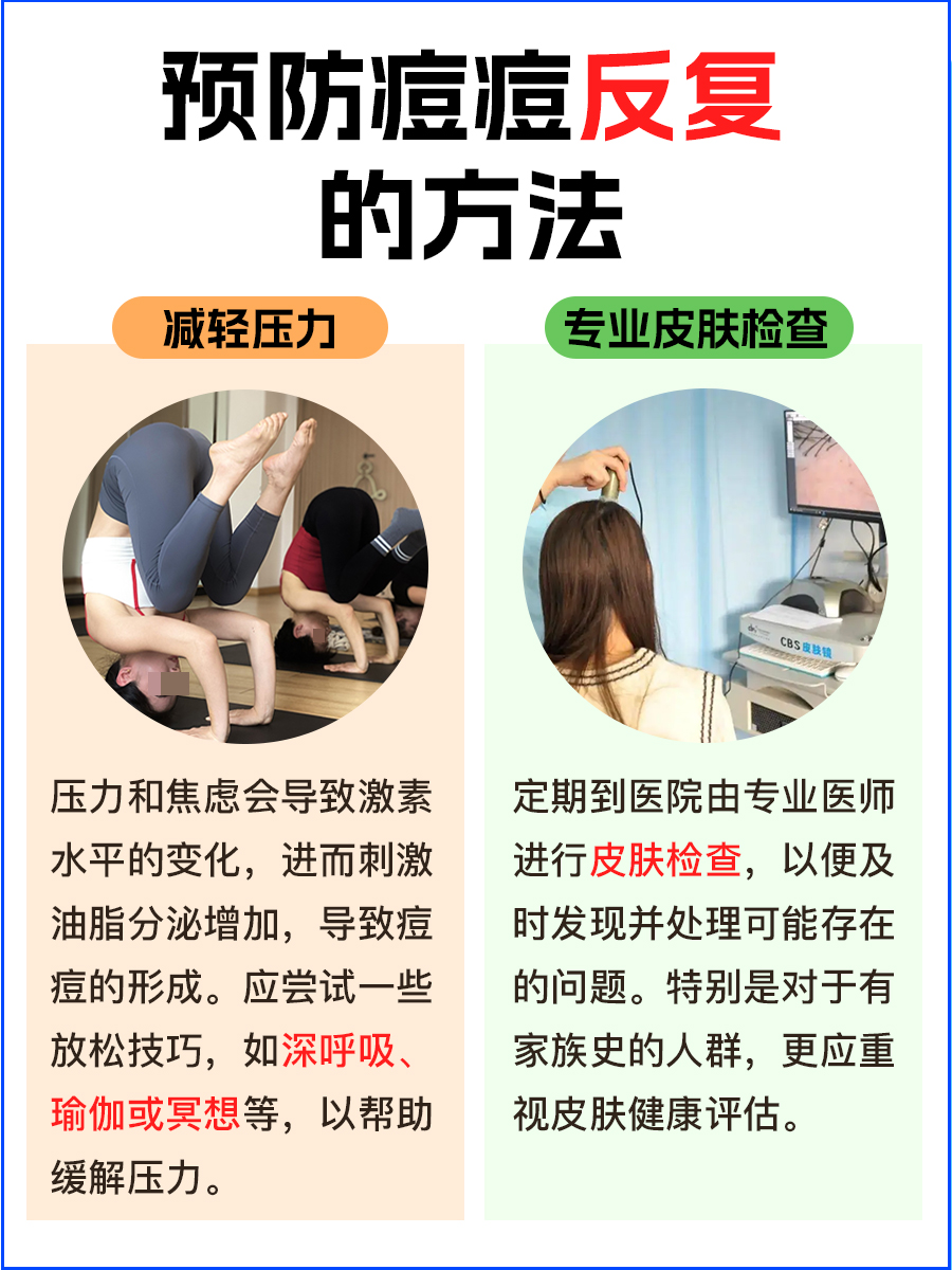 被痘痘困扰多年,这次终于找到救星了