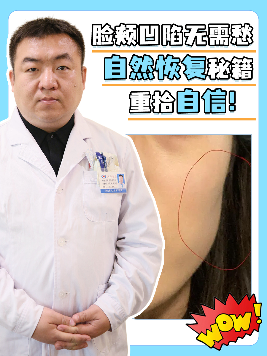 脸颊凹陷无需愁,自然恢复秘籍,重拾自信!