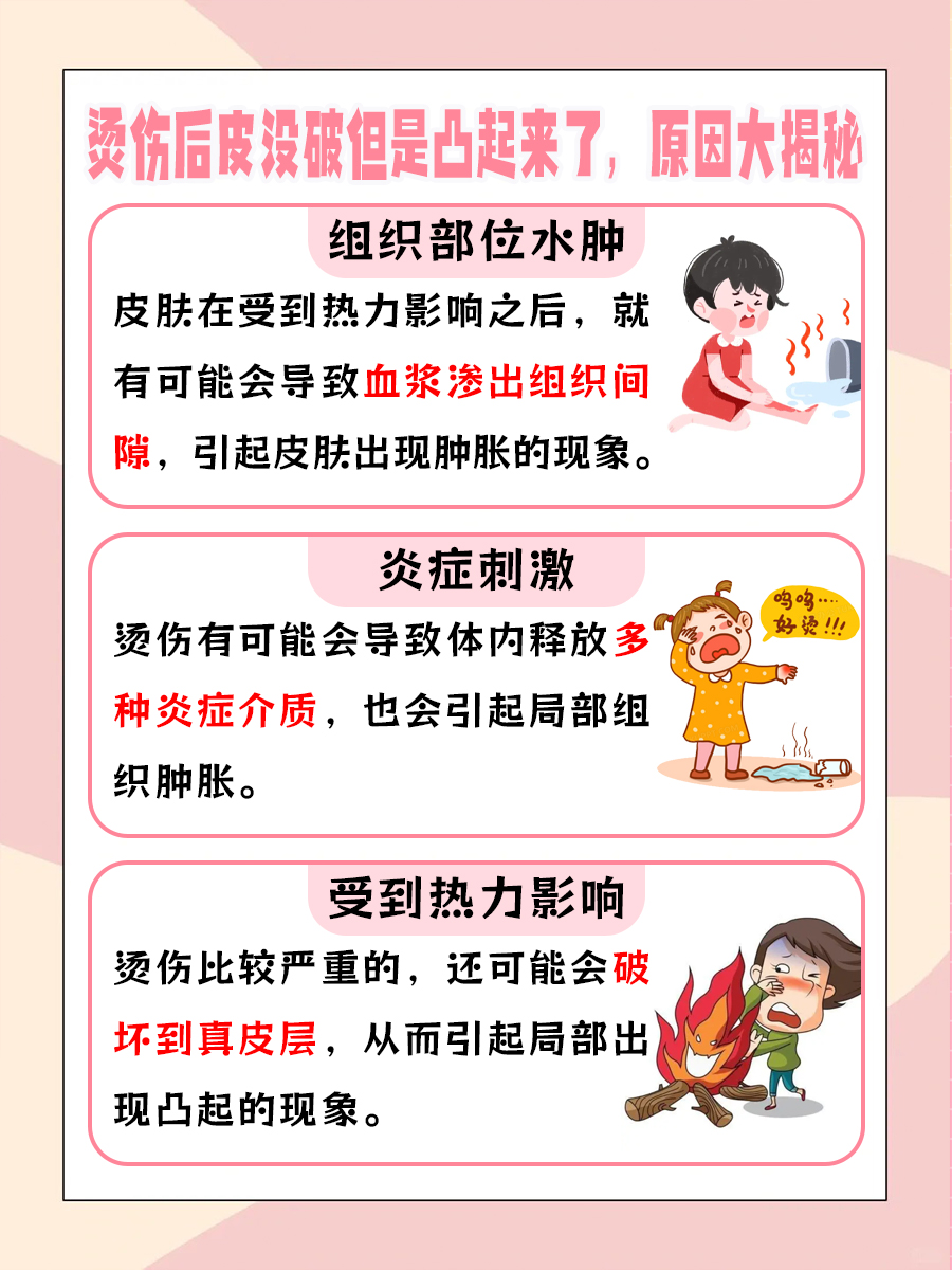 烫伤后皮没破但是凸起来了,原因大揭秘