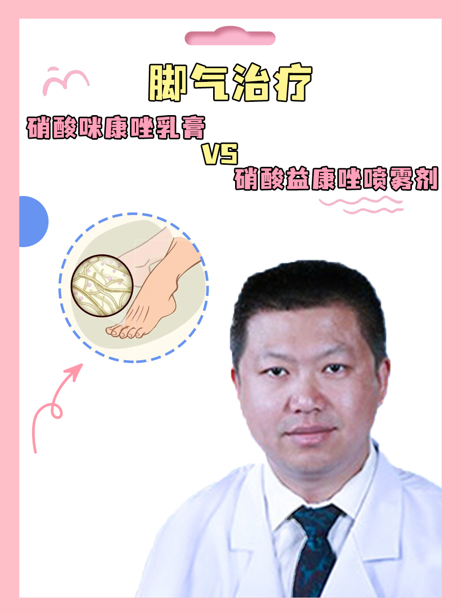 脚气治疗:硝酸咪康唑乳膏VS硝酸益康唑喷雾剂