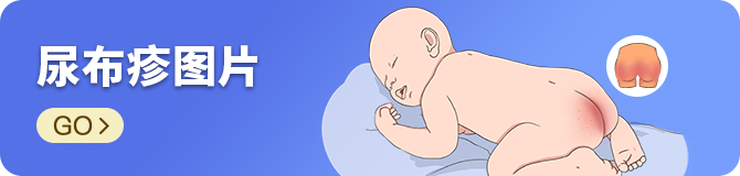尿布疹图片