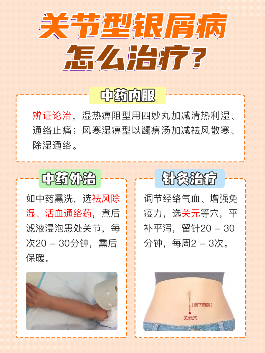 关节型银屑病咋处理?治疗法别错过