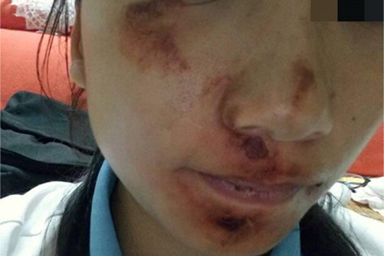 擦伤面部皮肤颜色改变图