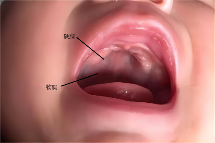 五个月宝宝上颚图