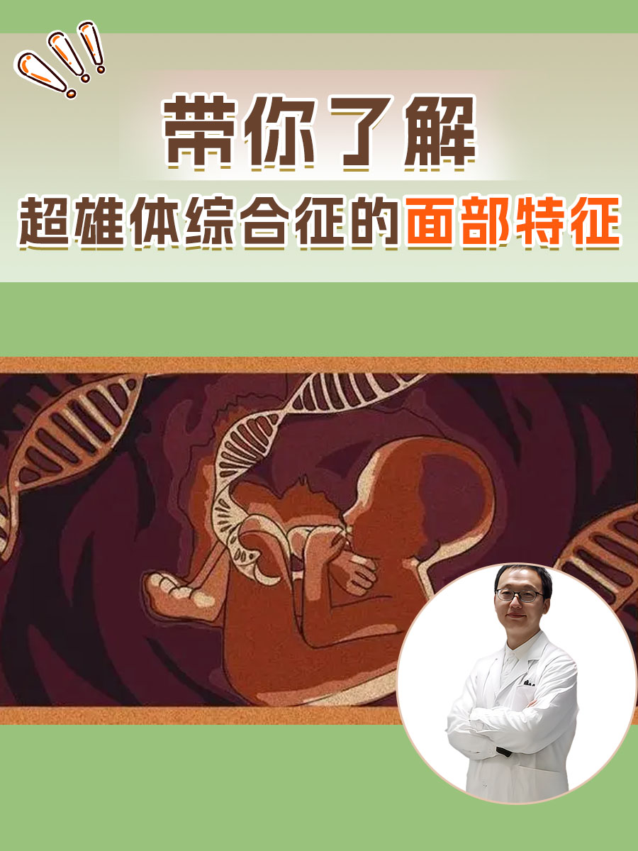 带你了解，超雄体综合征的面部特征