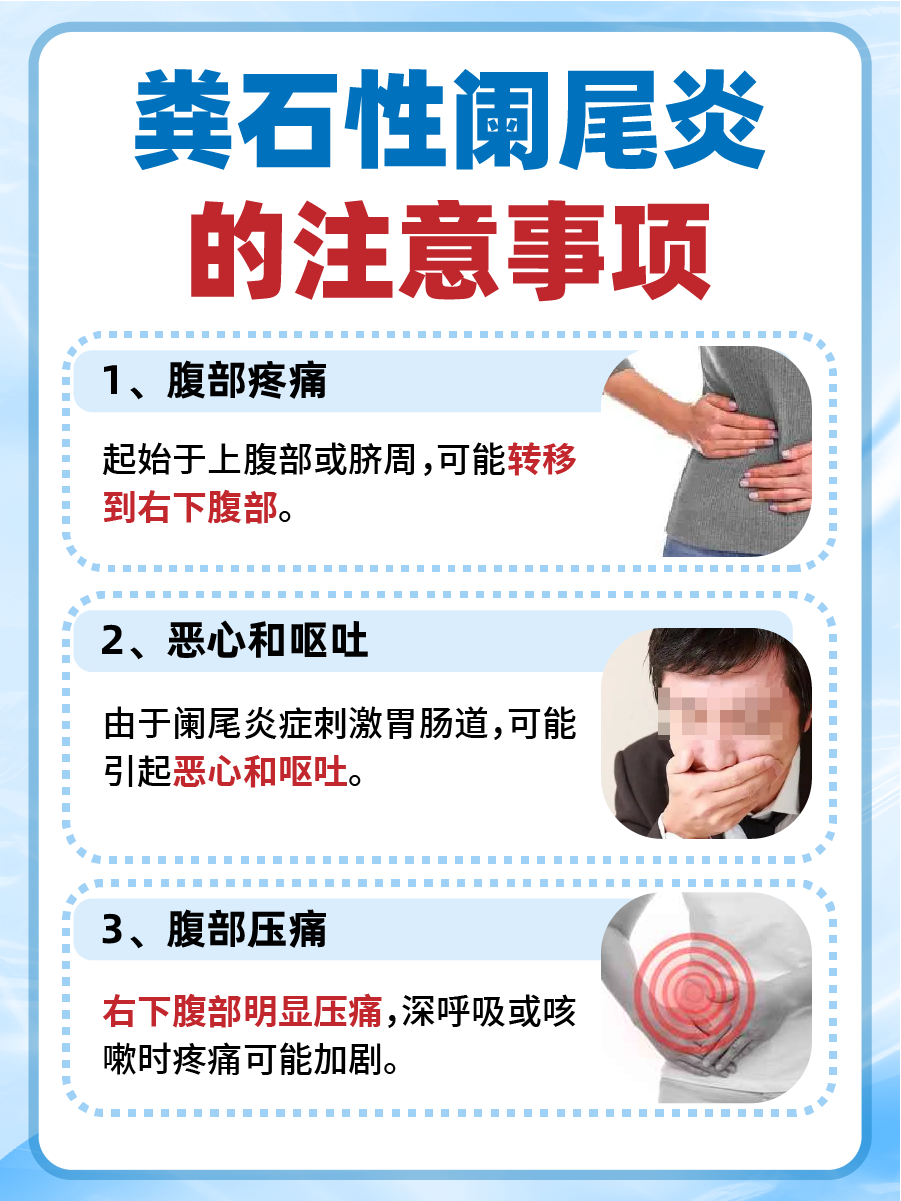 粪石性阑尾炎的早期症状有哪些?警惕这些信号