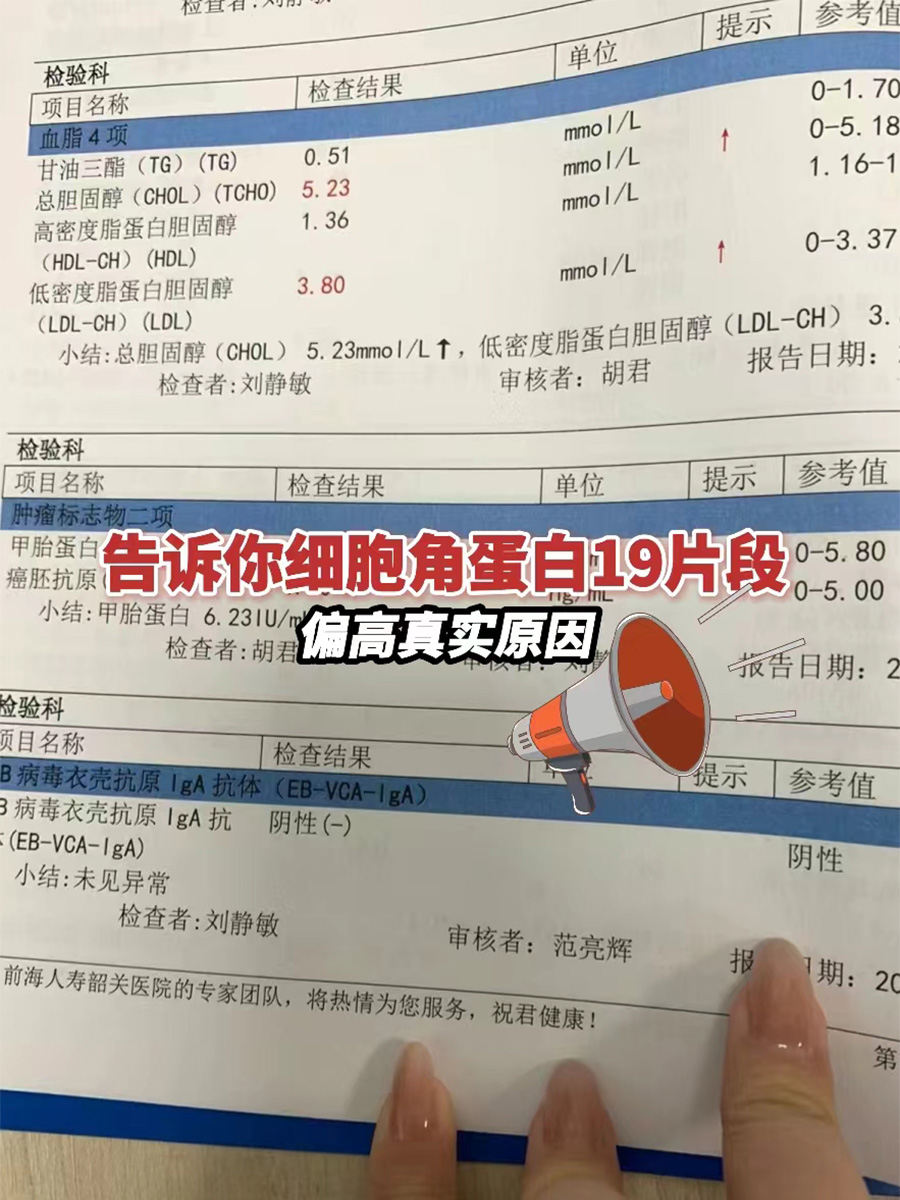 告诉你细胞角蛋白19片段偏高的真实原因！