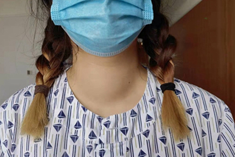 单纯性甲状腺肿脖子肿大图