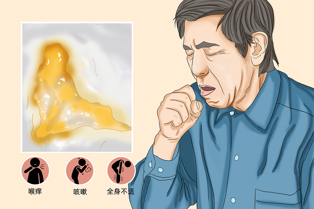 白痰和黄痰的区别