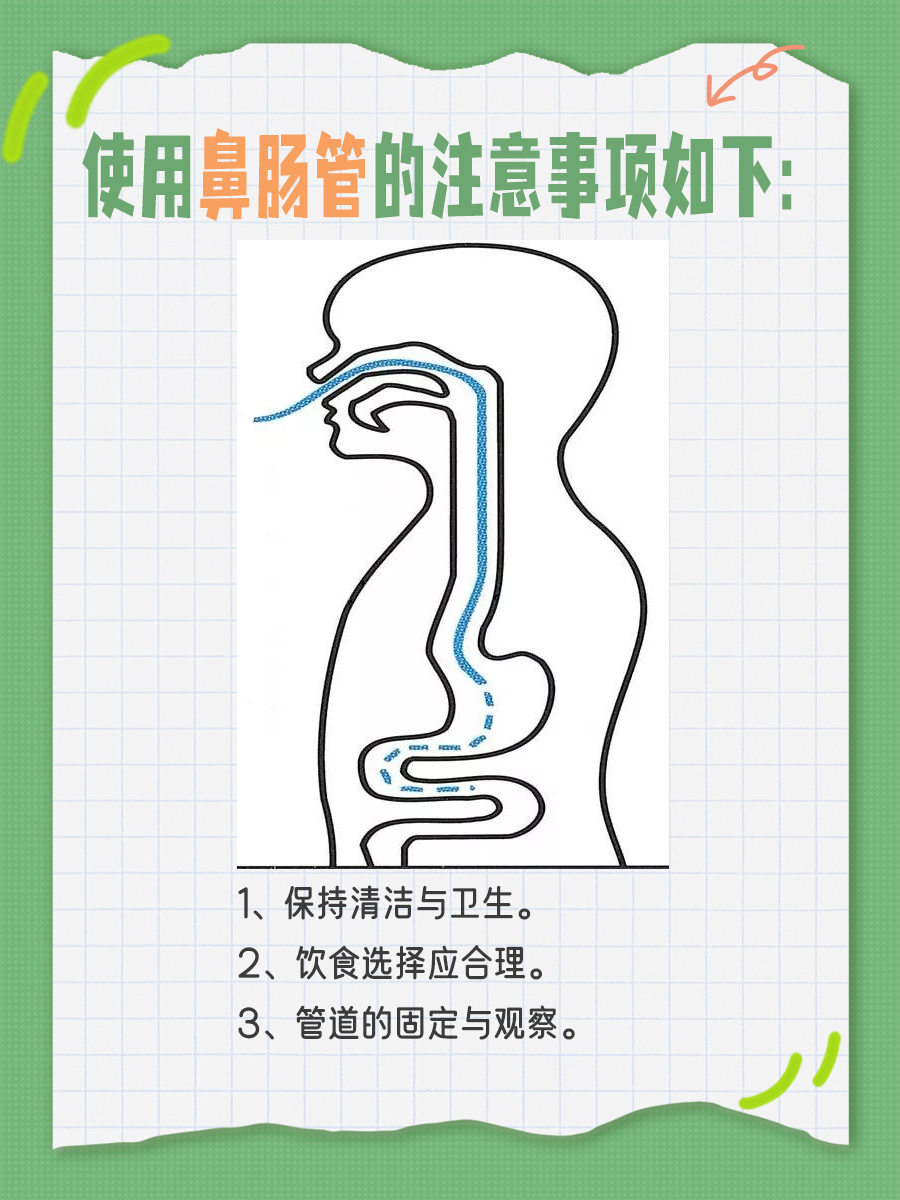鼻肠管日常护理要点：注意事项须知！
