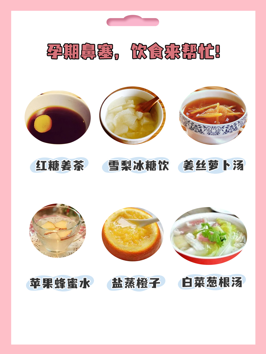 孕期鼻塞：试试这些缓解方法,告别呼吸不适！