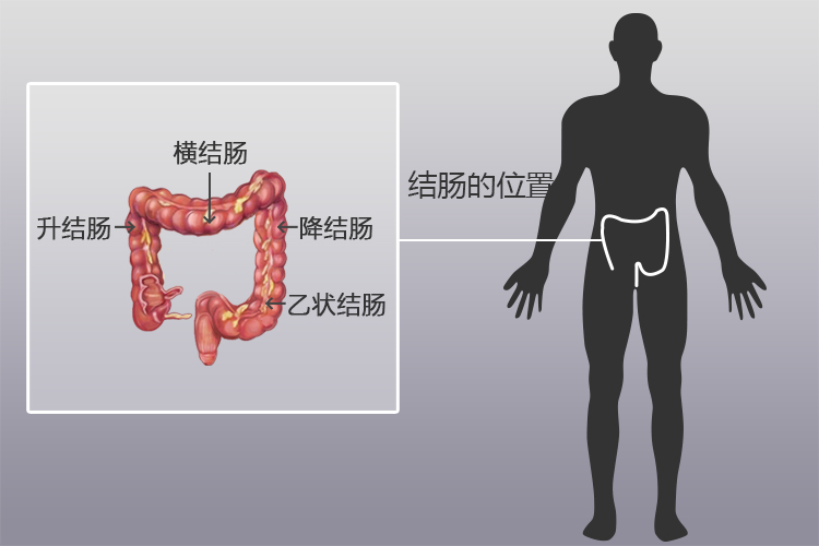 乙状结肠在什么位置图片