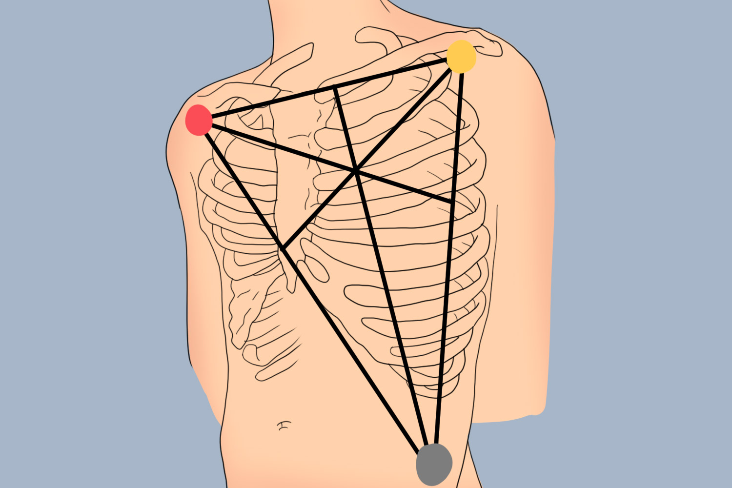 胸部电极贴片位置图示意图