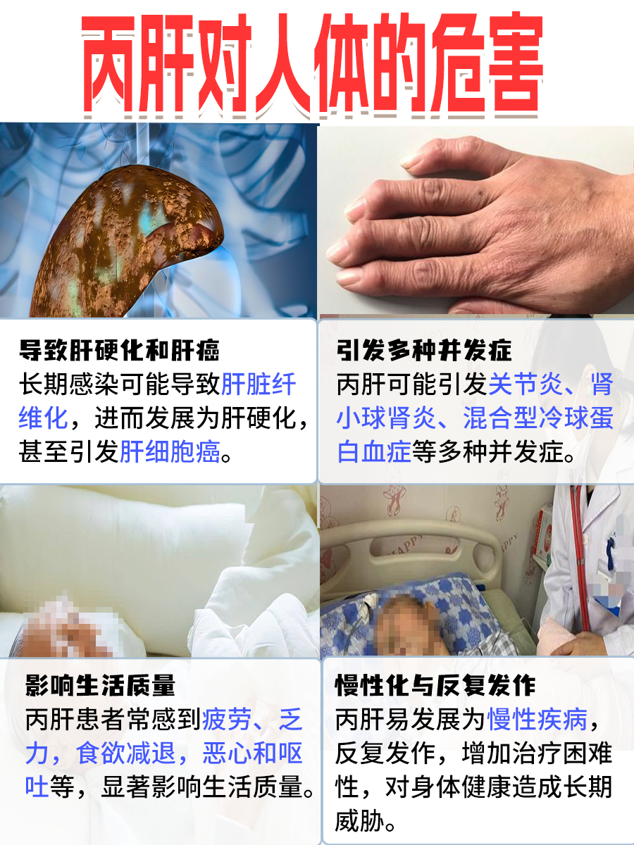 丙肝传染性强,为何夫妻间却很难传染?