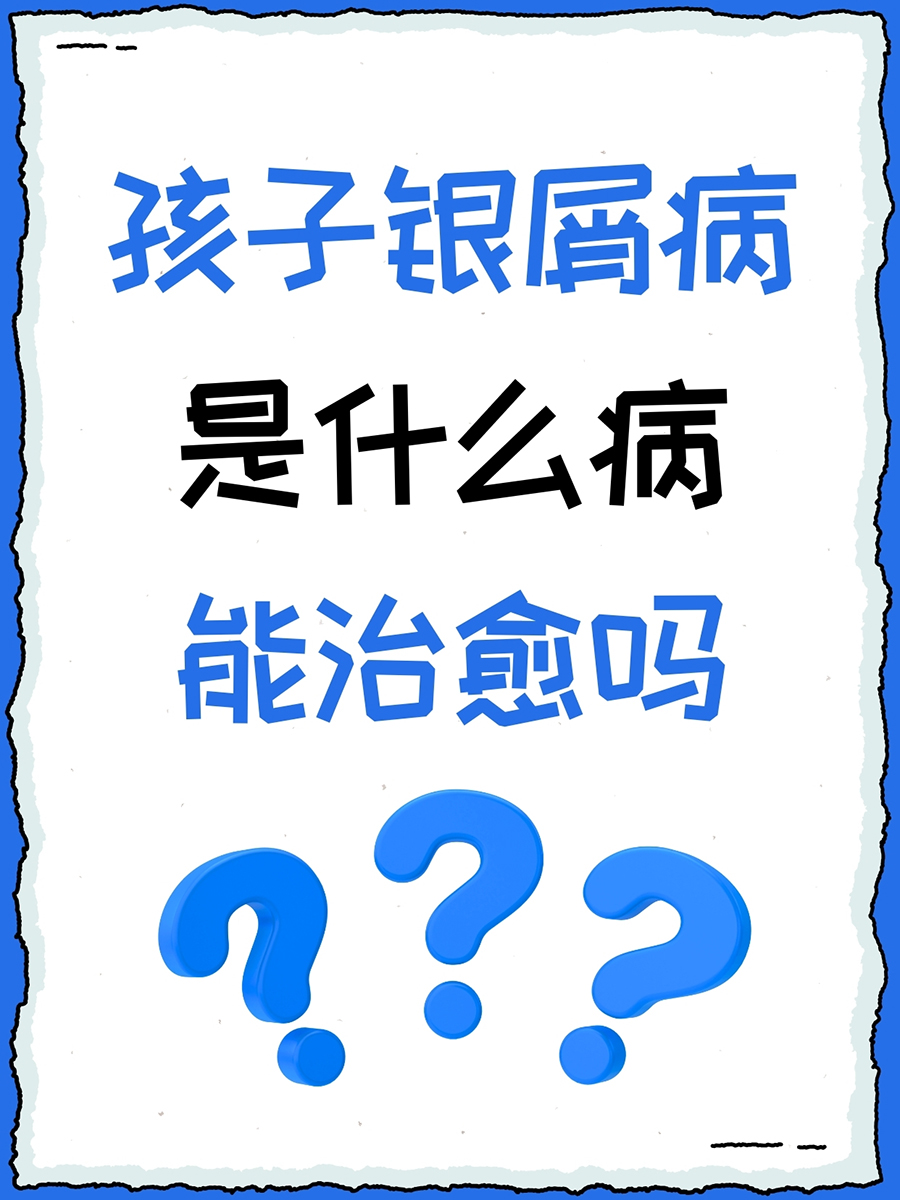 孩子银屑病是什么病，能治愈吗｜家长必看