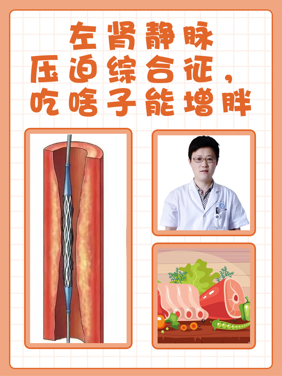 左肾静脉压迫综合征，吃啥子能增胖
