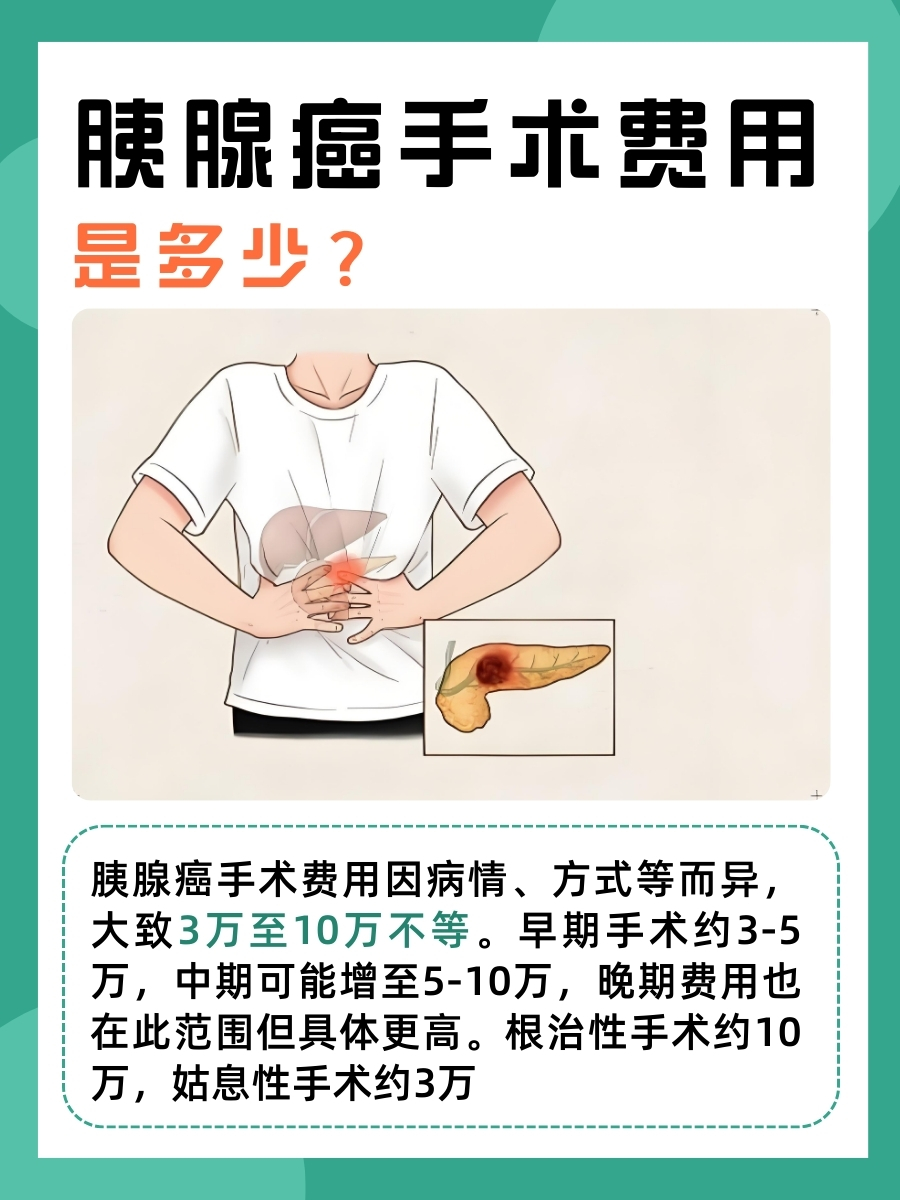 胰腺癌手术费用:医生揭晓!