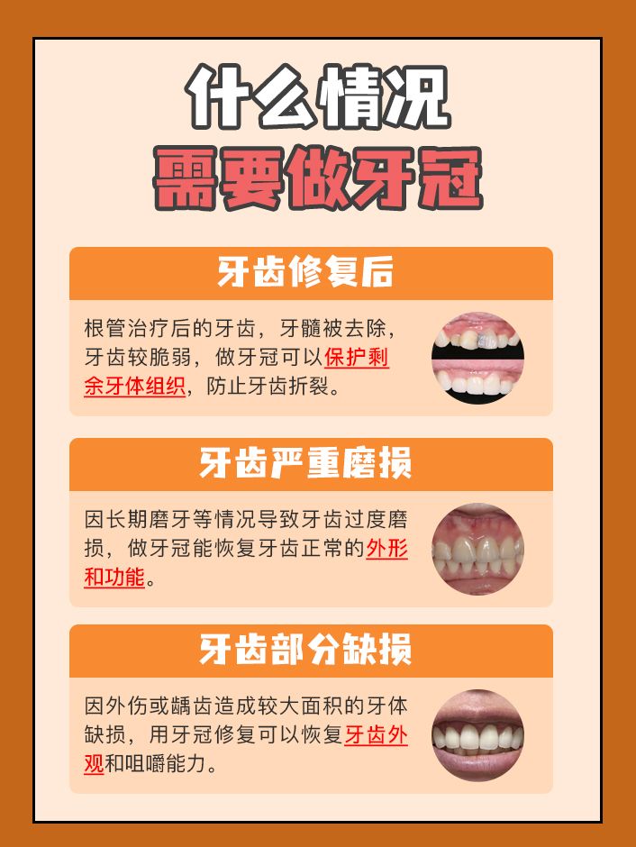 想做牙冠，却被价格吓退？做牙冠多少钱一颗