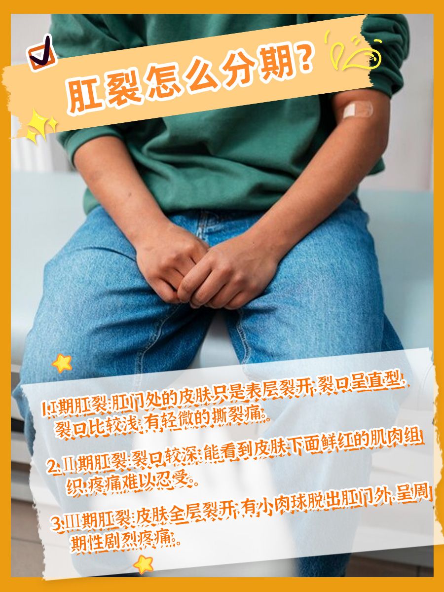 肛裂Ⅰ、Ⅱ、Ⅲ期怎么区分？怎么办？