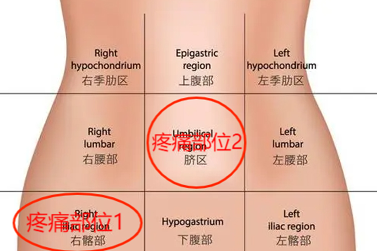 克罗恩病疼痛部位图