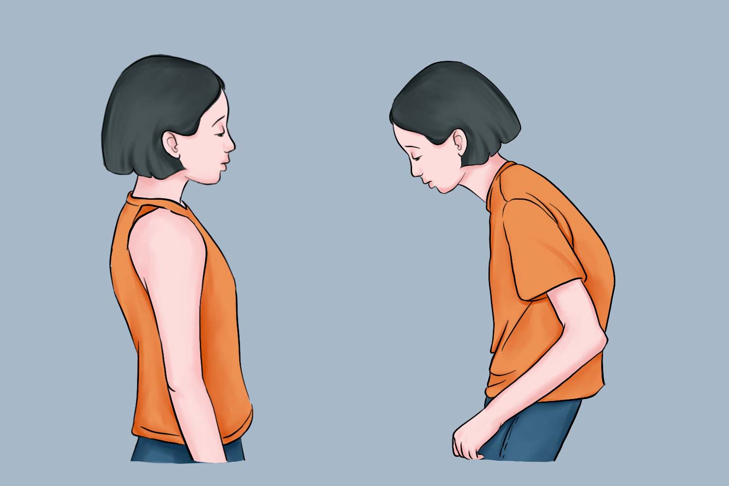 先天脊柱后凸与正常对比图