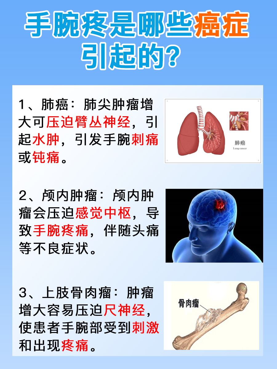 听听医生怎么说：什么癌症可引起手腕疼？