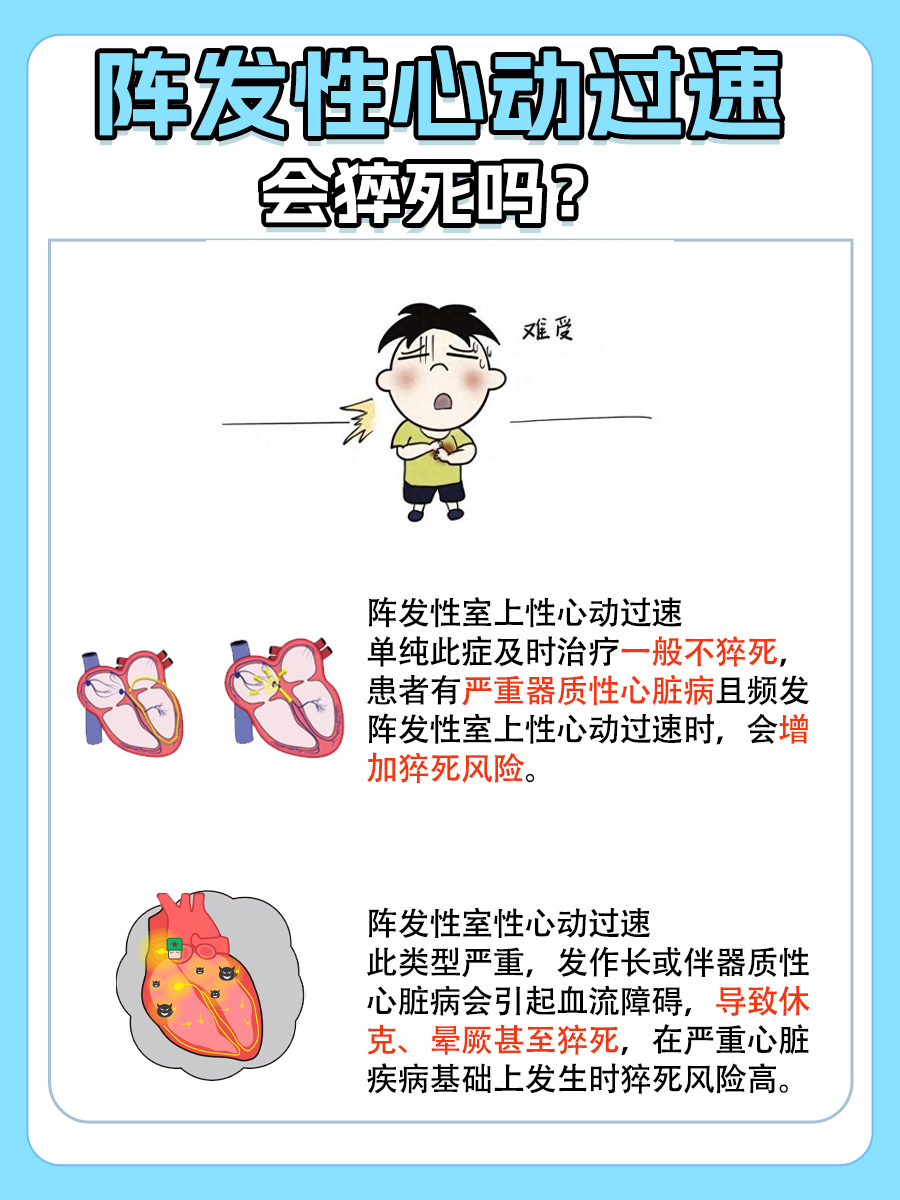 阵发性心动过速与猝死风险