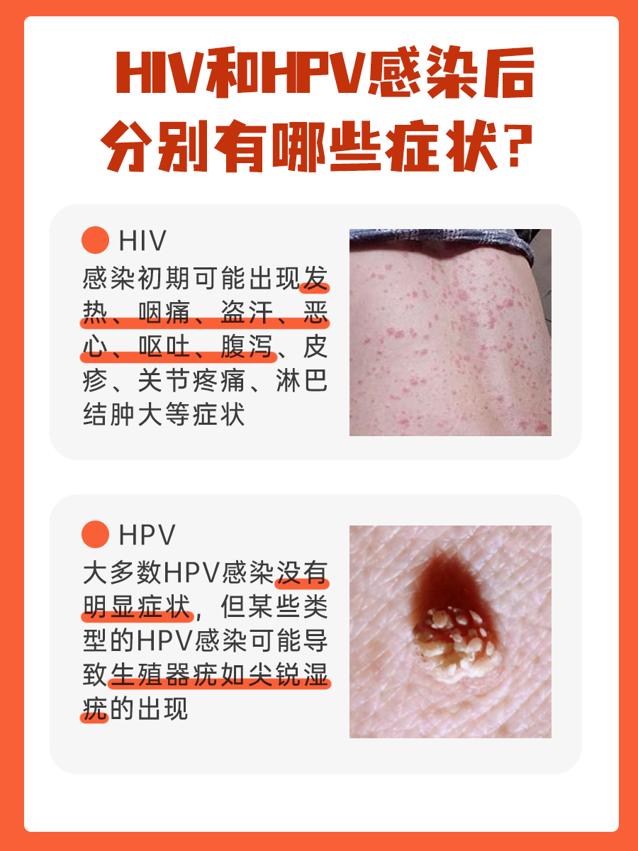 HIV和HPV哪个严重 ？医生来解答