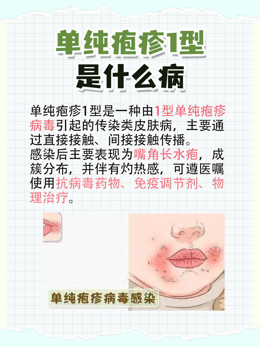 搞懂单纯疱疹1型是啥毛病,你知道吗?