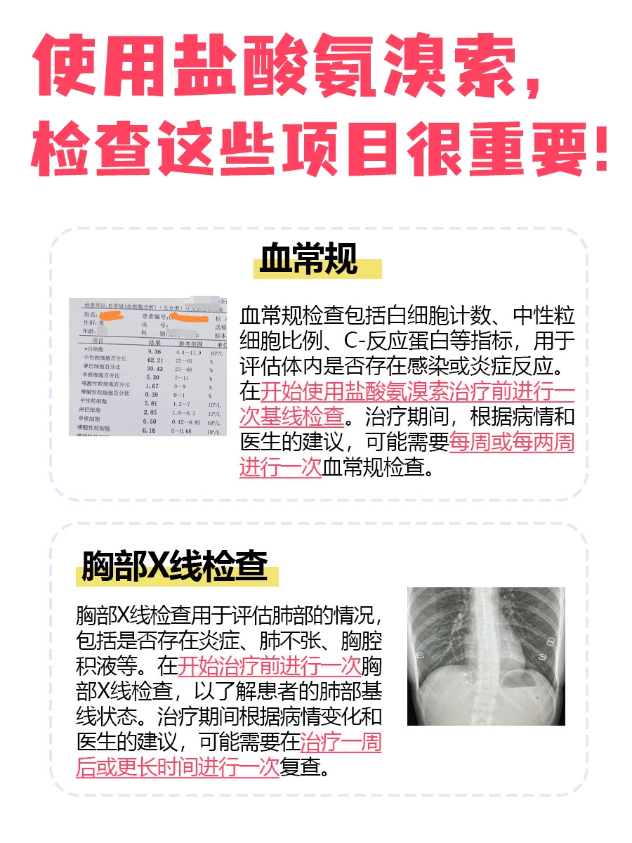 必看!一文说清盐酸氨溴索的功效与作用!