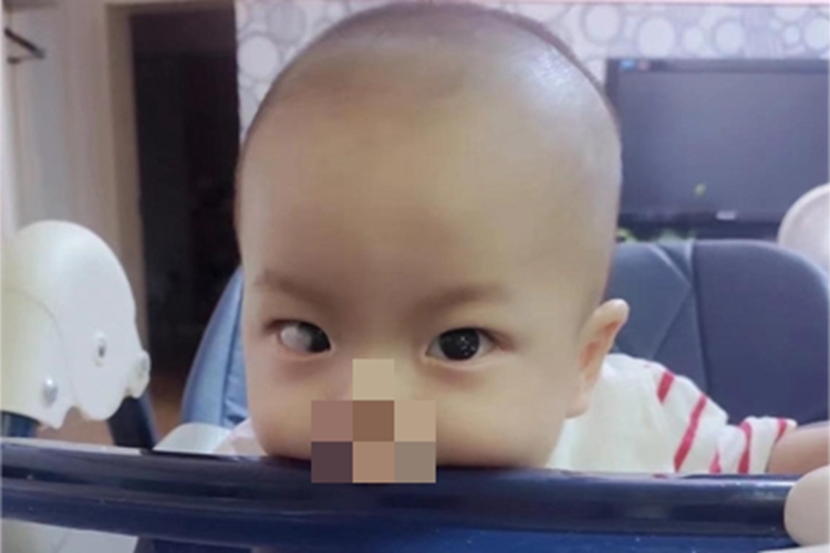 角膜皮样瘤黑眼球有白色肿物图