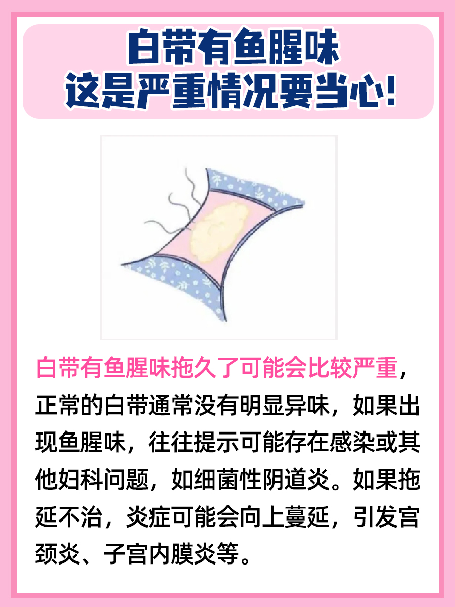 白带有腥味，拖延治疗后果严重吗