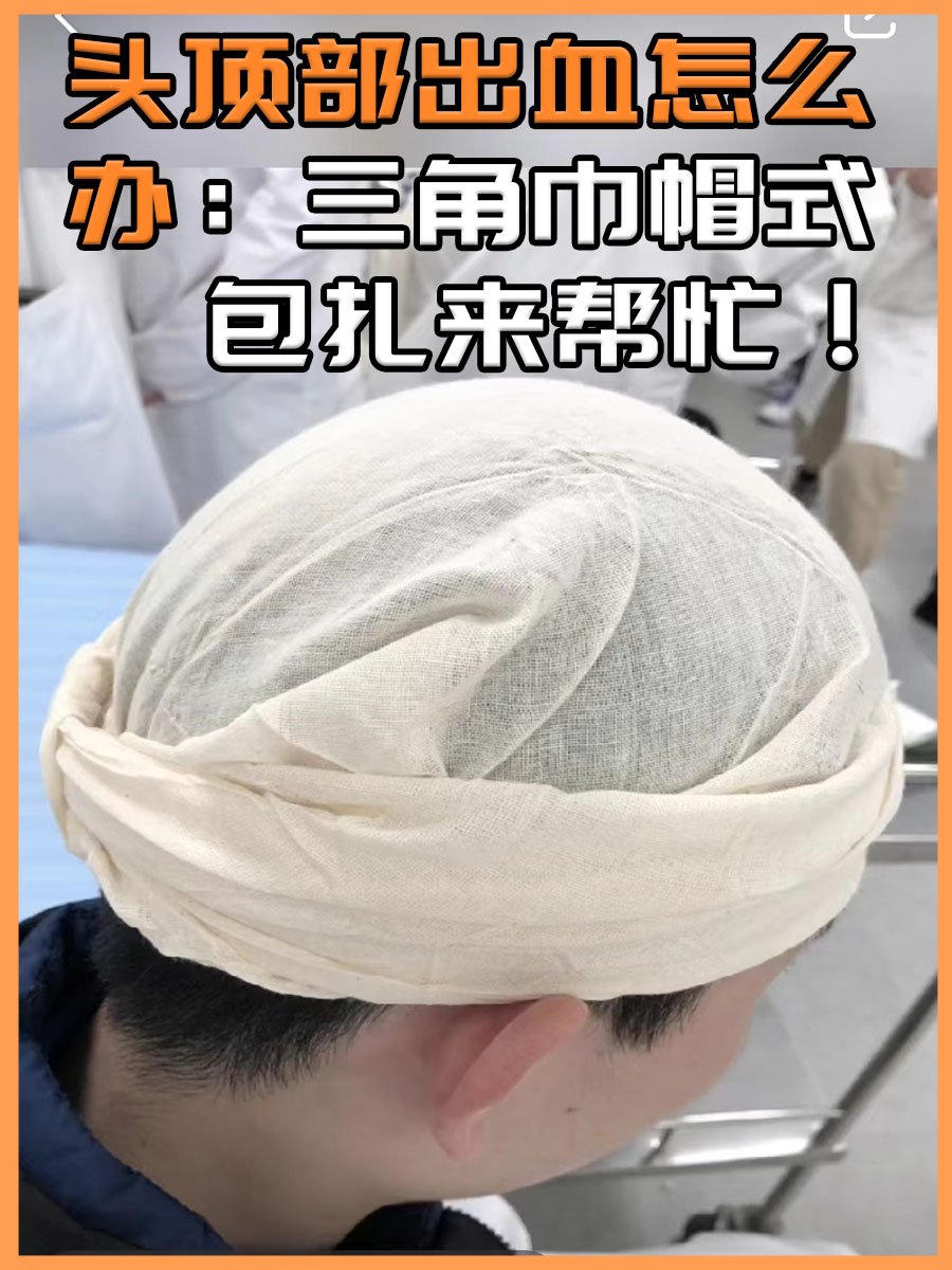头顶部出血怎么办：三角巾帽式包扎来帮忙！