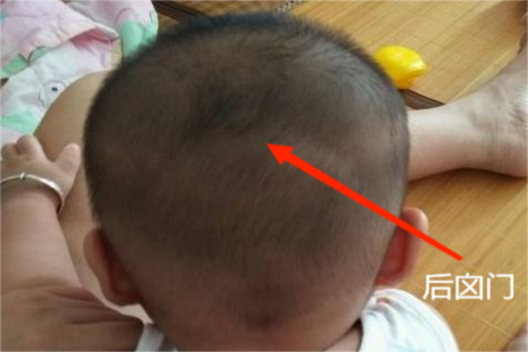 正常后囟门图