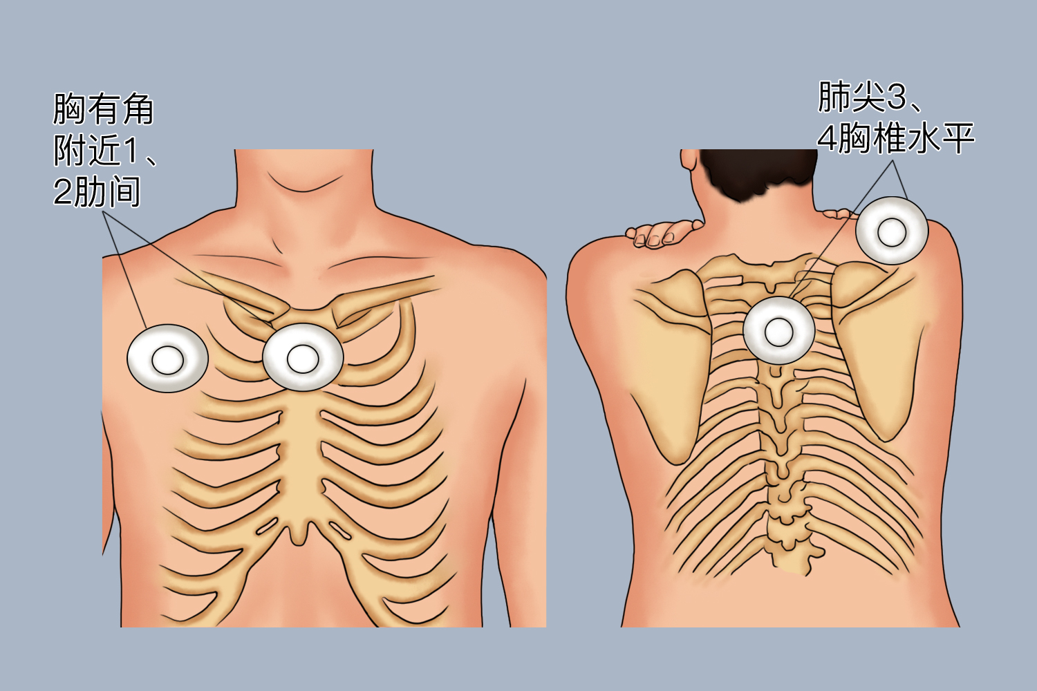支气管肺泡呼吸音听诊区图