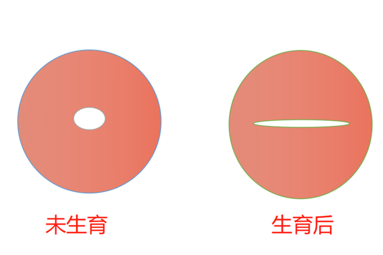 宫颈外口形态图 宫颈外口形态图