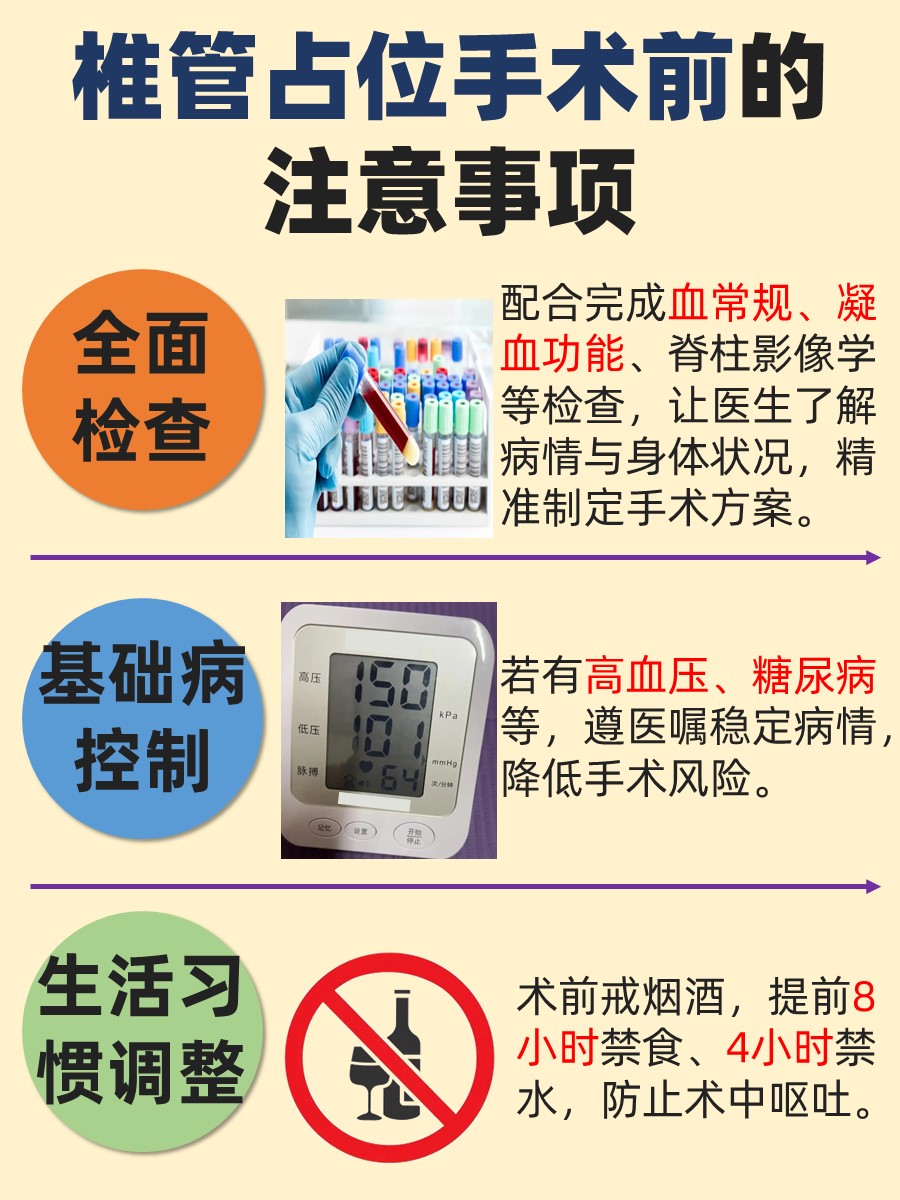 别错过！解析椎管占位手术大小的真相