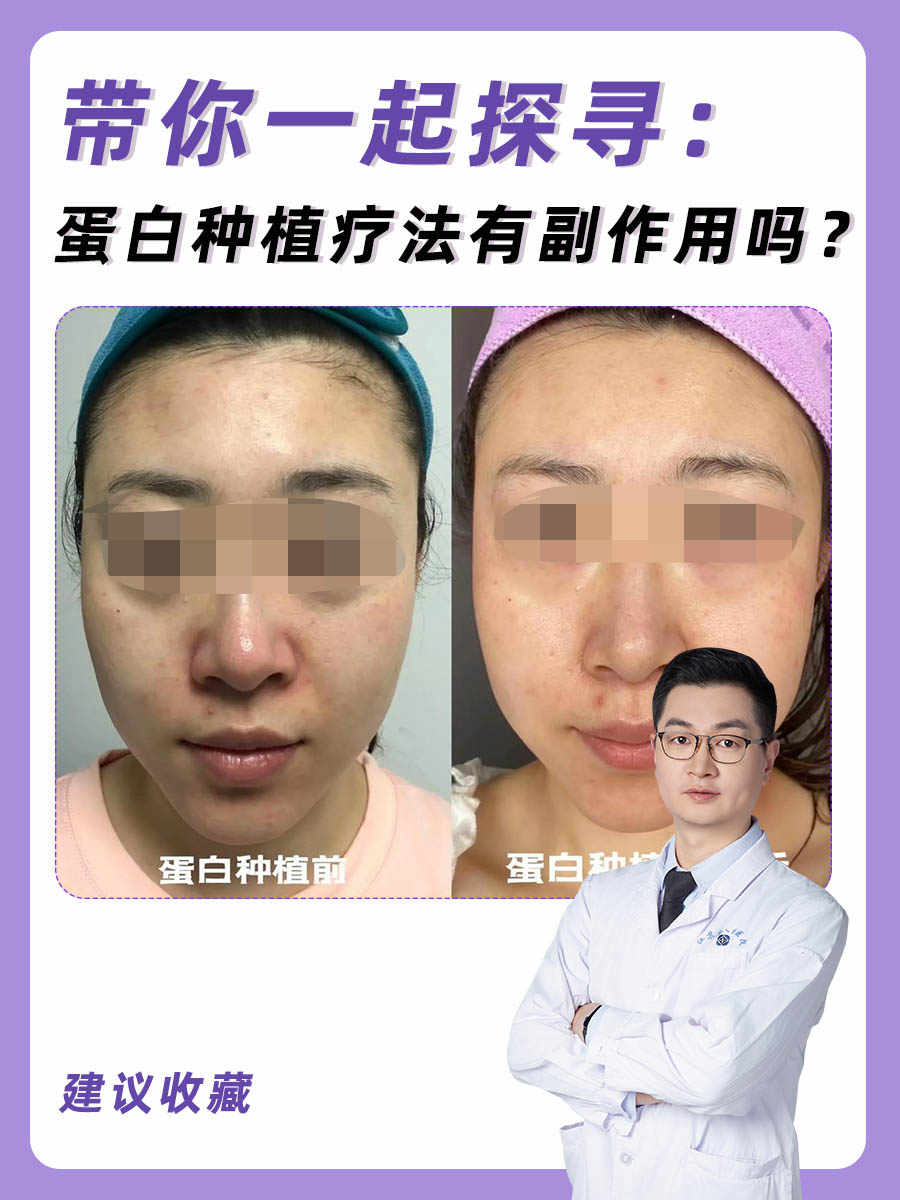 带你一起探寻：蛋白种植疗法有副作用吗？