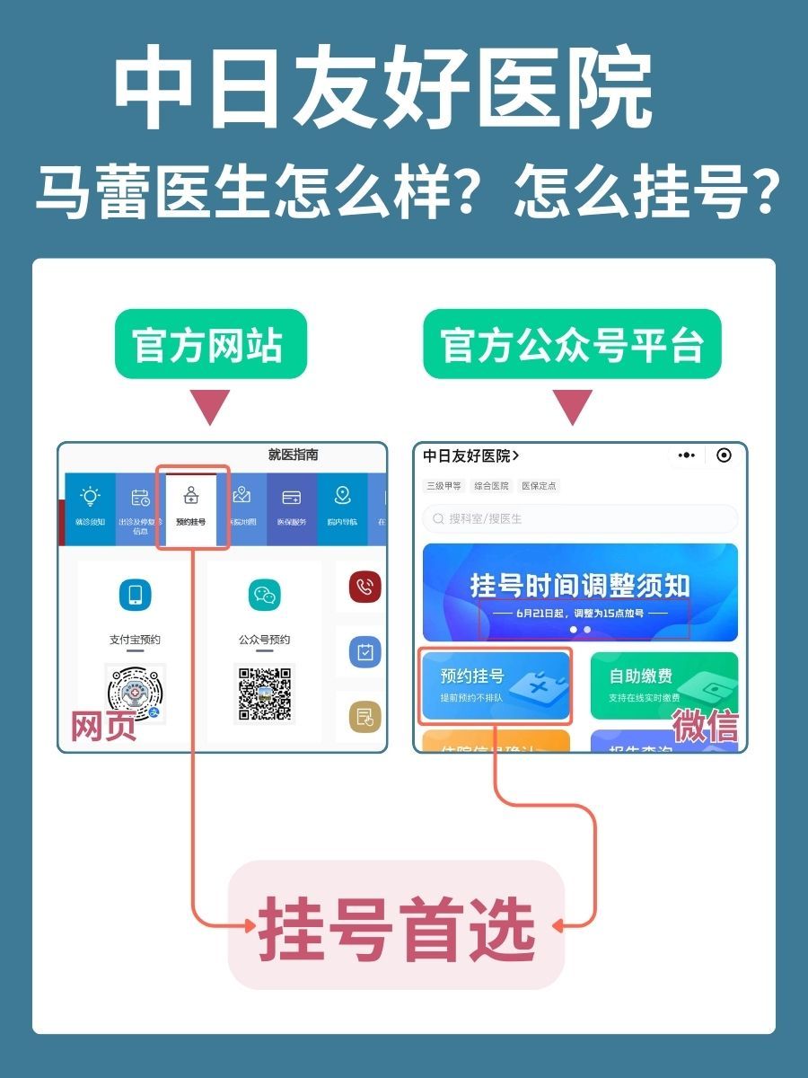 中日友好医院马蕾医生怎么样？怎么挂号？