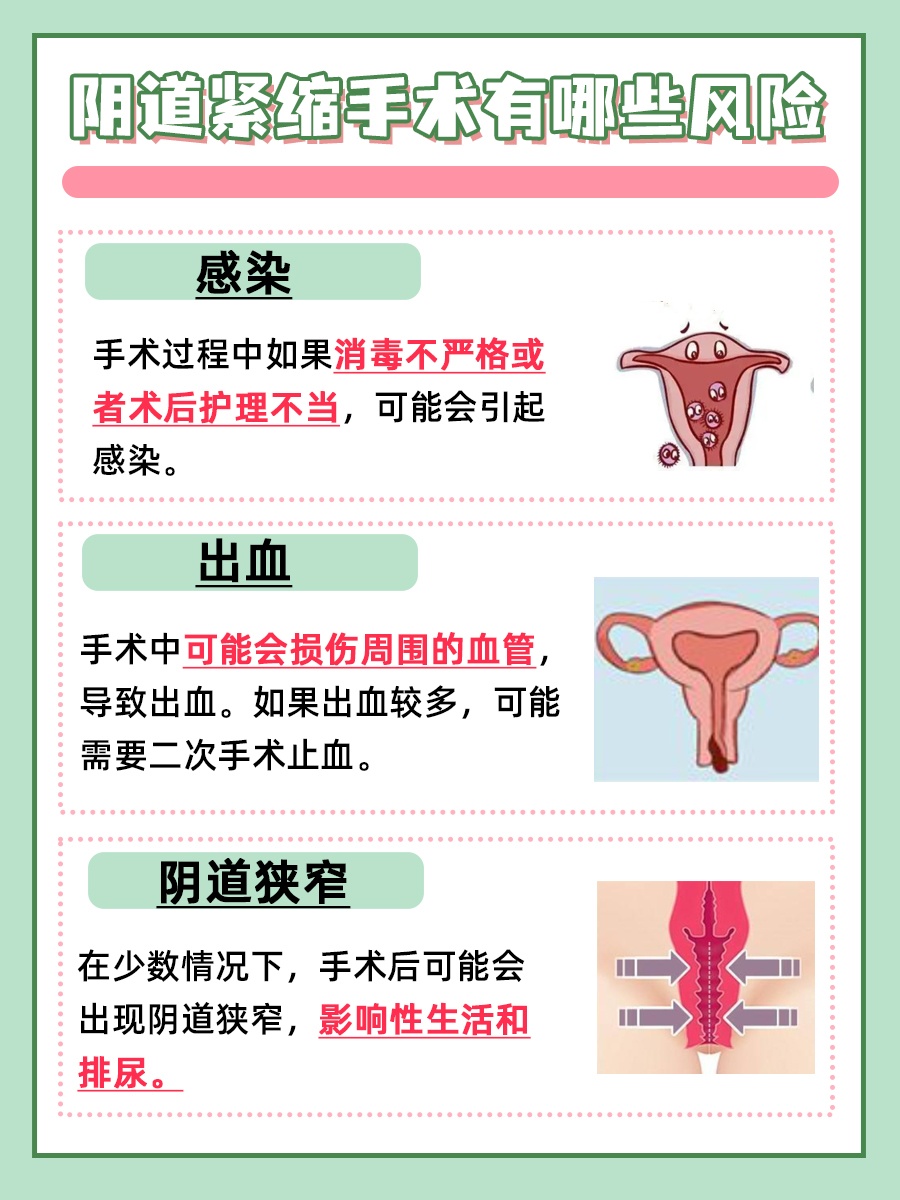阴道紧缩手术的效果好吗？一文解析