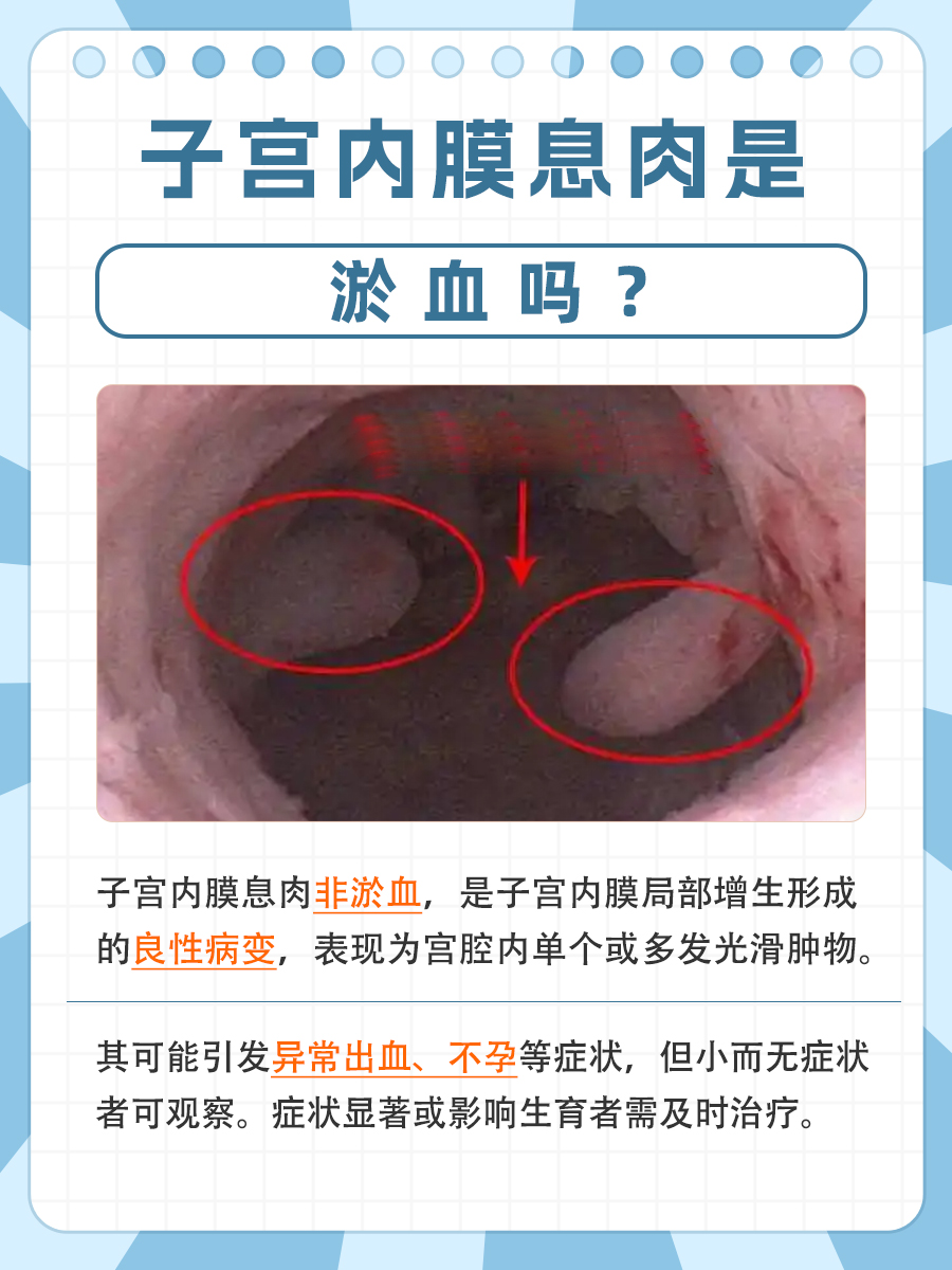 医生视角:子宫内膜息肉的真相?与淤血说拜拜!