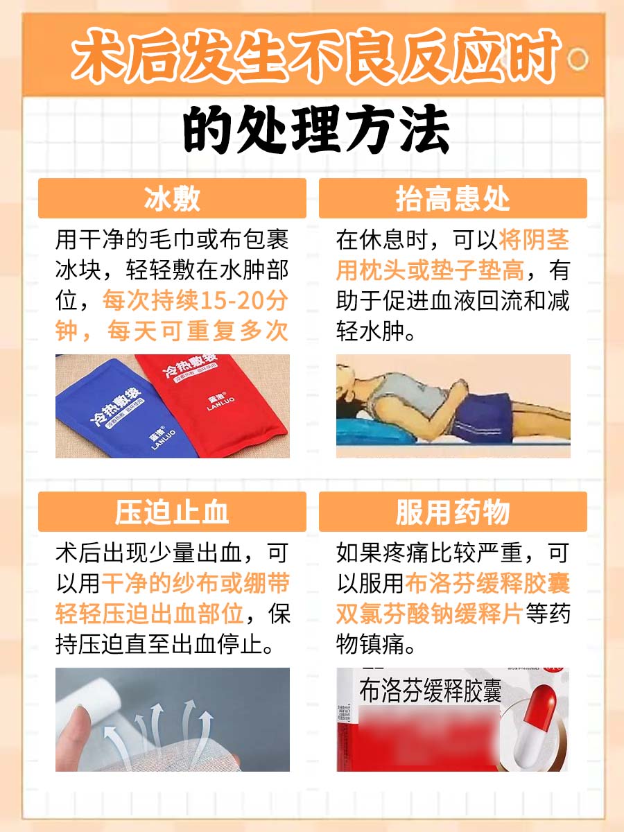 割包皮手术，要住院多长时间？一文带你了解！