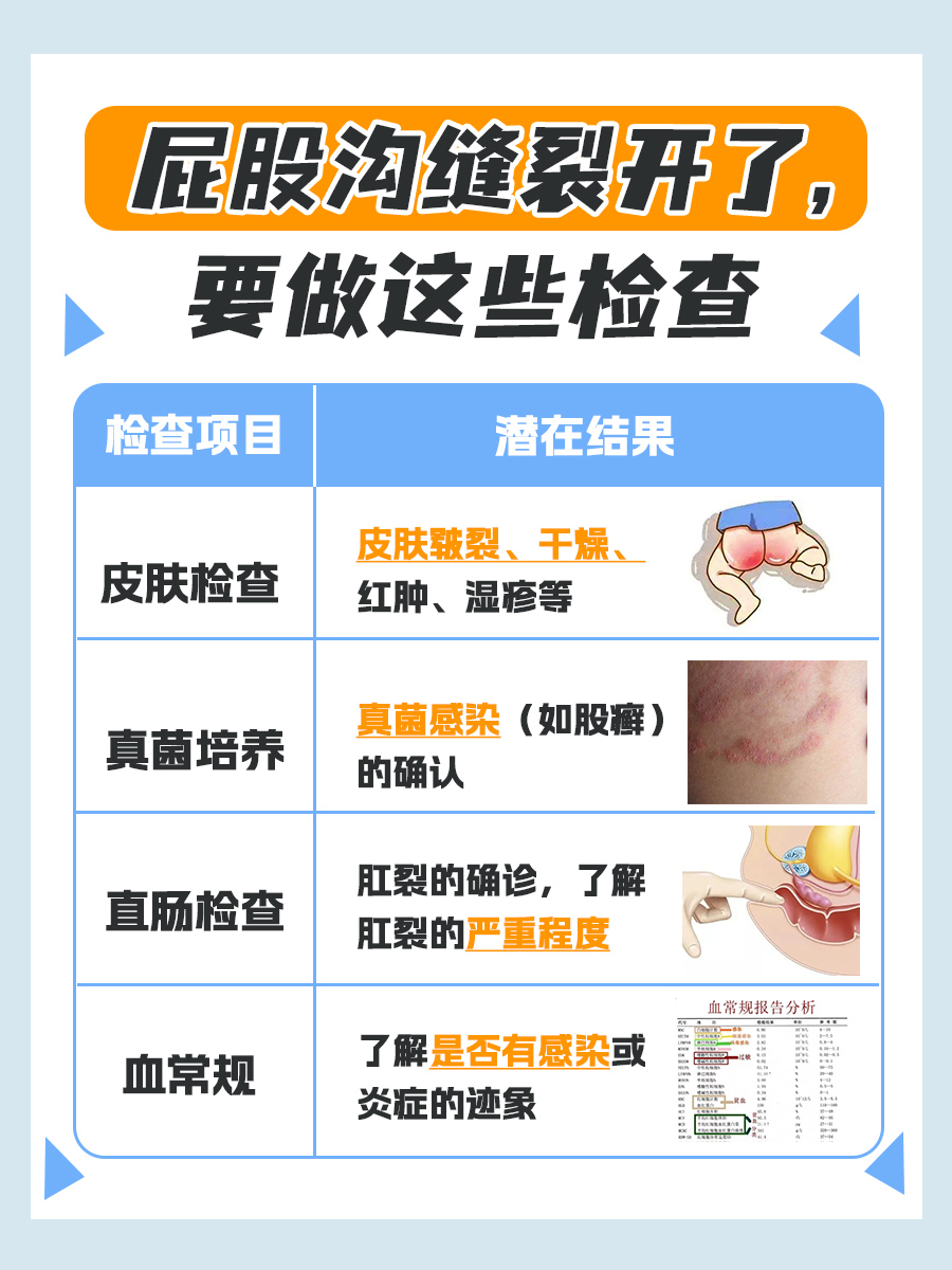 医生解析：屁股沟缝裂开了怎么回事