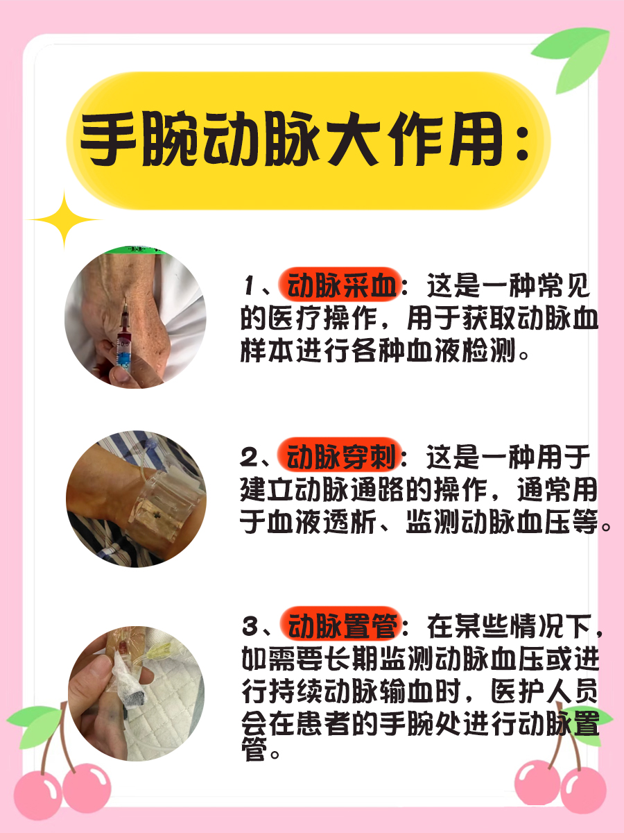 大揭秘！手腕动脉在皮下有多深？