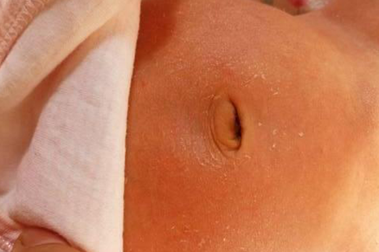 婴儿肚脐恢复好凹陷图