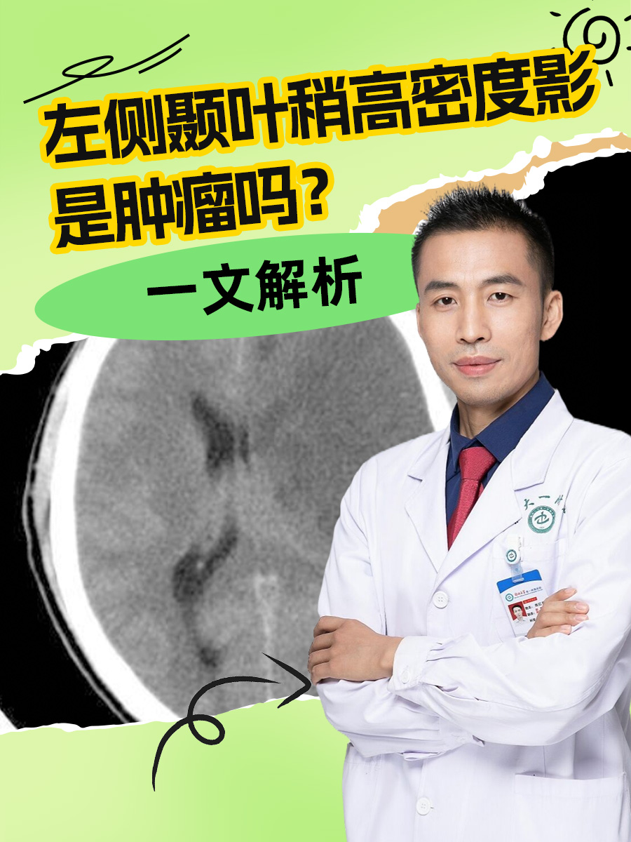 左侧颞叶稍高密度影是肿瘤吗？一文解析