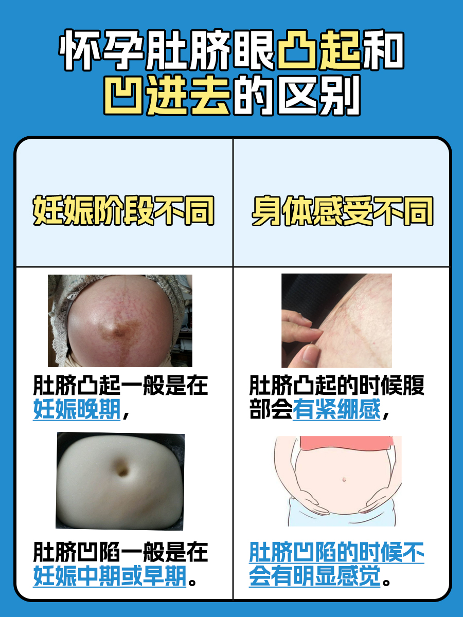揭秘,怀孕肚脐眼凸起和凹进去有什么区别?