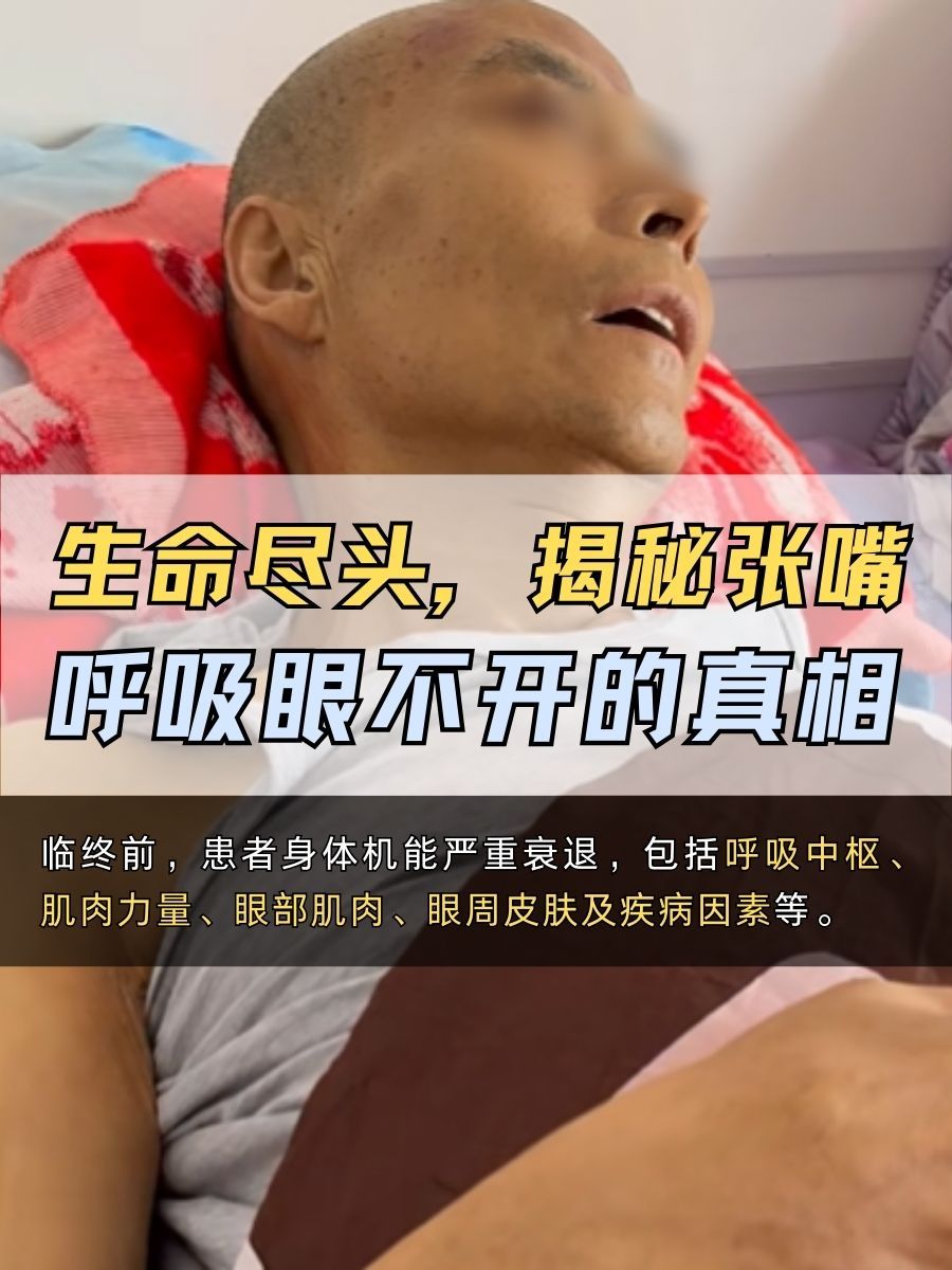 生命尽头，张嘴呼吸眼不开的真相在这里